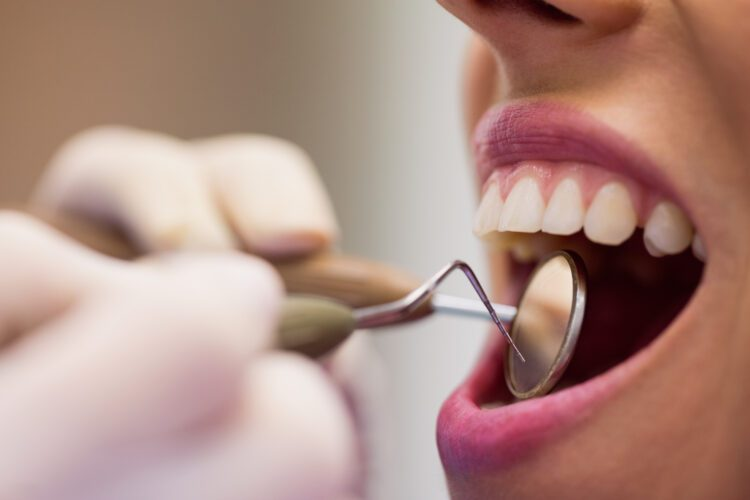 CEREC Crown Appointment