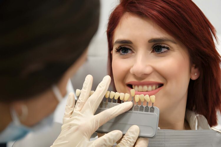 Porcelain Veneers vs Composite Veneers