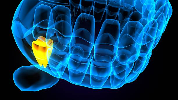 Oakville Dental Care | 3D Cone Beam Imaging vs Traditional X Rays Oakville Dental Care | 3D Cone Beam Imaging vs Traditional X Rays