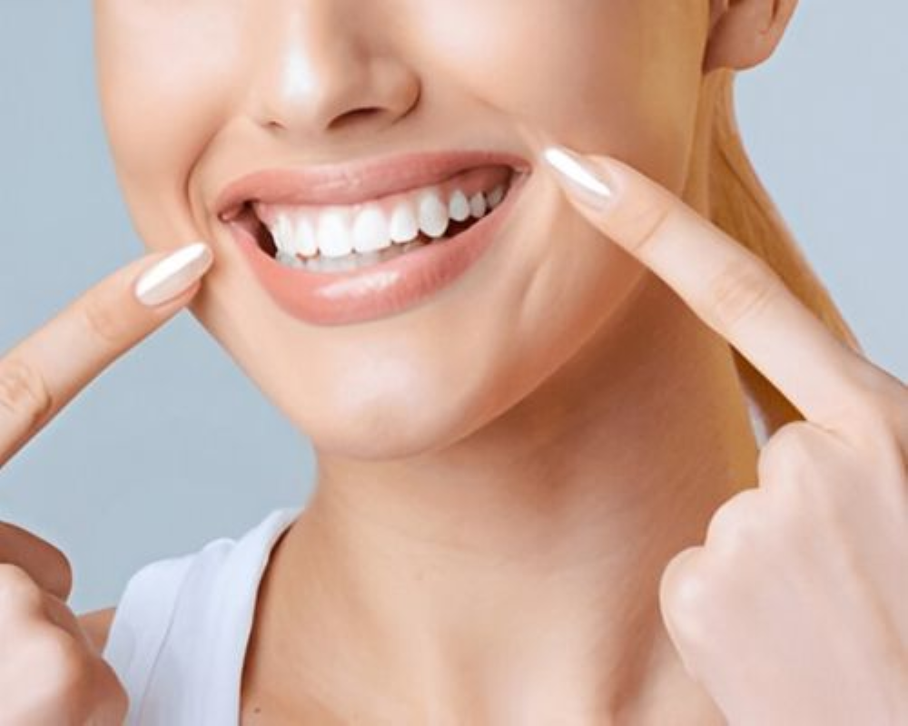 porcelain veneers